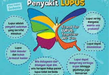 Deteksi Dini Lupus: Langkah Penting di Fasilitas Kesehatan