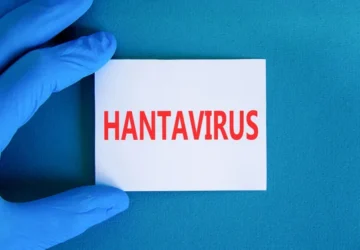Kemenkes: 23 Kasus Hantavirus di Indonesia, Tiga Meninggal Sejak 2024
