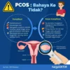 PCOS Berubah Jadi PMOS: Apa Itu dan Bagaimana Mengatasi