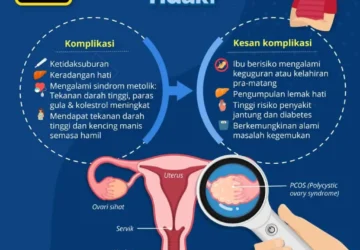 PCOS Berubah Jadi PMOS: Apa Itu dan Bagaimana Mengatasi