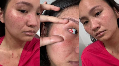 Korban KDRT: Perjalanan Rumah Tangga Katryna yang Berubah menjadi Tempat Paling Ditakutinya