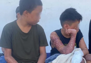 Santri di Lombok Dibakar dan Diancam untuk Tidak Melaporkan