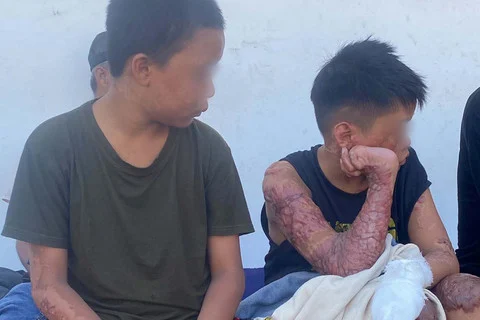 Santri di Lombok Dibakar dan Diancam untuk Tidak Melaporkan